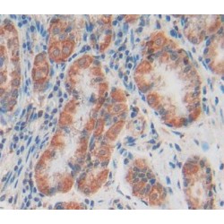 Cytoglobin (CYGB) Antibody