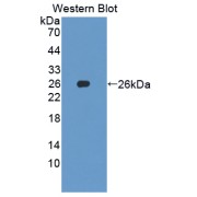 Western blot analysis of recombinant Human SKP1 using S-Phase Kinase Associated Protein 1 (SKP1) Antibody.