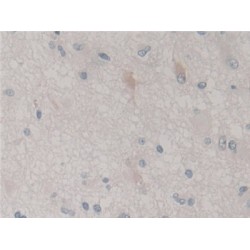 S-Phase Kinase Associated Protein 1 (SKP1) Antibody