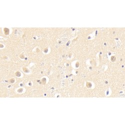 S-Phase Kinase Associated Protein 1 (SKP1) Antibody