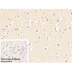 S-Phase Kinase Associated Protein 1 (SKP1) Antibody