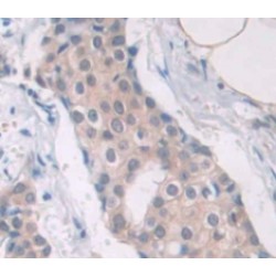 Cancer/Testis Antigen 1B (CTAG1B) Antibody