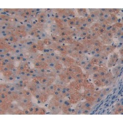 Aldolase B, Fructose Bisphosphate (ALDOB) Antibody
