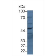 Western blot analysis of Human Serum, using Human PLB Antibody (2 µg/ml) and HRP-conjugated Goat Anti-Rabbit antibody (<a href="https://www.abbexa.com/index.php?route=product/search&amp;search=abx400043" target="_blank">abx400043</a>, 0.2 µg/ml).