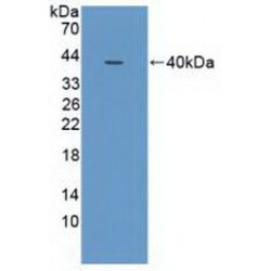 Nuclear Receptor Coactivator 3 (NCOA3) Antibody