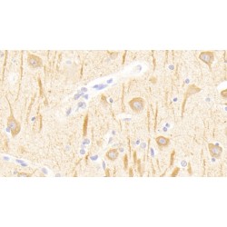 Glutamate Receptor, Metabotropic 1 (GRM1) Antibody