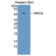 Western blot analysis of recombinant Human Translocator Protein (with N-terminal His and GST tags).