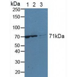 Lysyl tRNA Synthetase (KARS) Antibody