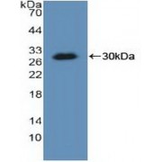 Western blot analysis of recombinant Human KARS.
