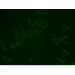 Tight Junction Protein ZO-2 (TJP2) Antibody
