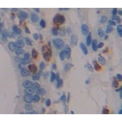Dual Specificity Phosphatase 5 (DUSP5) Antibody