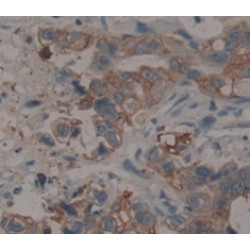 Eukaryotic Translation Elongation Factor 1 Gamma (EEF1g) Antibody