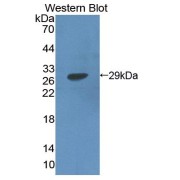 Western blot analysis of the recombinant protein.