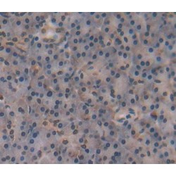 Nuclear Receptor Subfamily 5 Group A Member 2 (NR5A2) Antibody