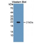 Western blot analysis of recombinant Human RBM3.