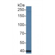 Western blot analysis of Human Jurkat cell lysate, using Human UBAP2 Antibody (1 µg/ml) and HRP-conjugated Goat Anti-Rabbit antibody (<a href="https://www.abbexa.com/index.php?route=product/search&amp;search=abx400043" target="_blank">abx400043</a>, 0.2 µg/ml).