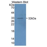 Western blot analysis of recombinant Human AIM1.