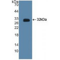 C-Terminal Binding Protein 2 (CTBP2) Antibody
