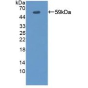 Western blot analysis of recombinant Human EVPL.