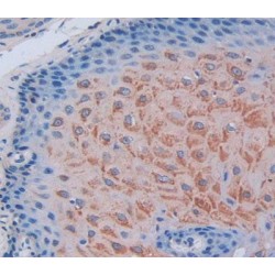 Envoplakin (EVPL) Antibody