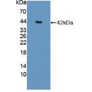 Western blot analysis of recombinant Human HDAC9.