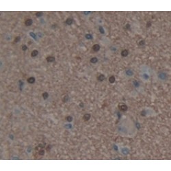 Histone Deacetylase 9 (HDAC9) Antibody