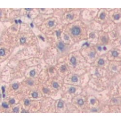 Mitoferrin (MFRN) Antibody