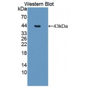 Western blot analysis of the recombinant Human MTR protein.