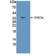Western blot analysis of recombinant Human RIPK1.