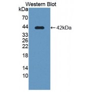Western blot analysis of recombinant Human SLC39A6 protein.