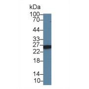 abx128304