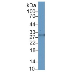 Asialoglycoprotein Receptor 2 (ASGR2) Antibody