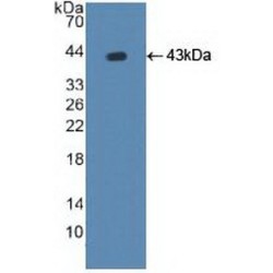 Copper Transporting ATPase 2 (ATP7B) Antibody