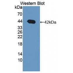 3-Hydroxybutyrate Dehydrogenase 1 (BDH1) Antibody