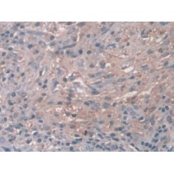 Cathepsin Z (CTSZ) Antibody