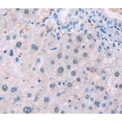 Neutral Sphingomyelinase Activation Associated Factor (NSMAF) Antibody