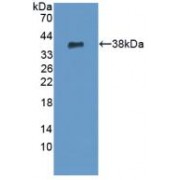 Western blot analysis of recombinant Human PADI6.