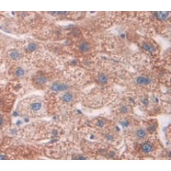 Steroid Sulfatase Isozyme S (STS) Antibody