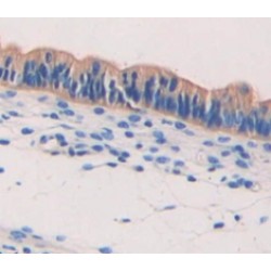 Syncoilin (SYNC) Antibody