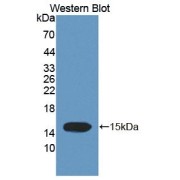 Western blot analysis of recombinant Human TCHH Protein.
