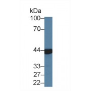 Western blot analysis of Pig Kidney lysate, using Human ACY1 Antibody (2 µg/ml) and HRP-conjugated Goat Anti-Rabbit antibody (<a href="https://www.abbexa.com/index.php?route=product/search&amp;search=abx400043" target="_blank">abx400043</a>, 0.2 µg/ml).