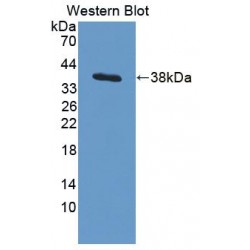 Actin Related Protein 2/3 Complex Subunit 2 (ARPC2) Antibody