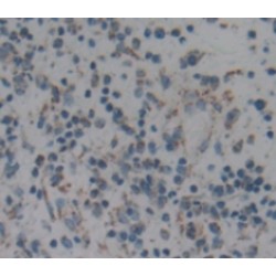 Actin Related Protein 2/3 Complex Subunit 2 (ARPC2) Antibody