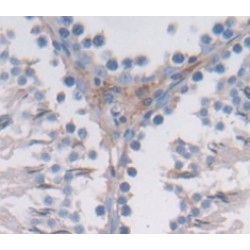 Breast Cancer Anti-Estrogen Resistance 1 (BCAR1) Antibody