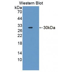 Biotinidase (BTD) Antibody