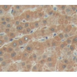 Biotinidase (BTD) Antibody