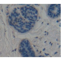 Calponin 1, Basic (CNN1) Antibody