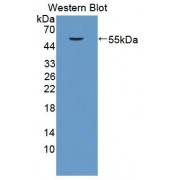 Western blot analysis of recombinant Human GDA.