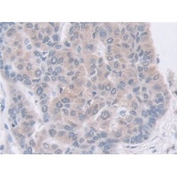 Guanine Deaminase (GDA) Antibody