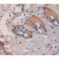 Interleukin-1 Family Member 10 (IL1F10) Antibody